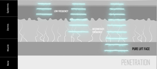 PureLift vs Microcurrent | Which is the Right Facial Treatment for You?