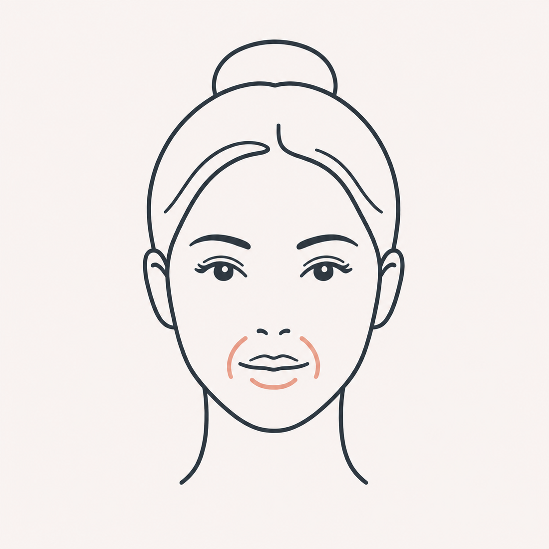 Around the mouth treatment zone, where marionette lines run from the mouth corners toward the jaw