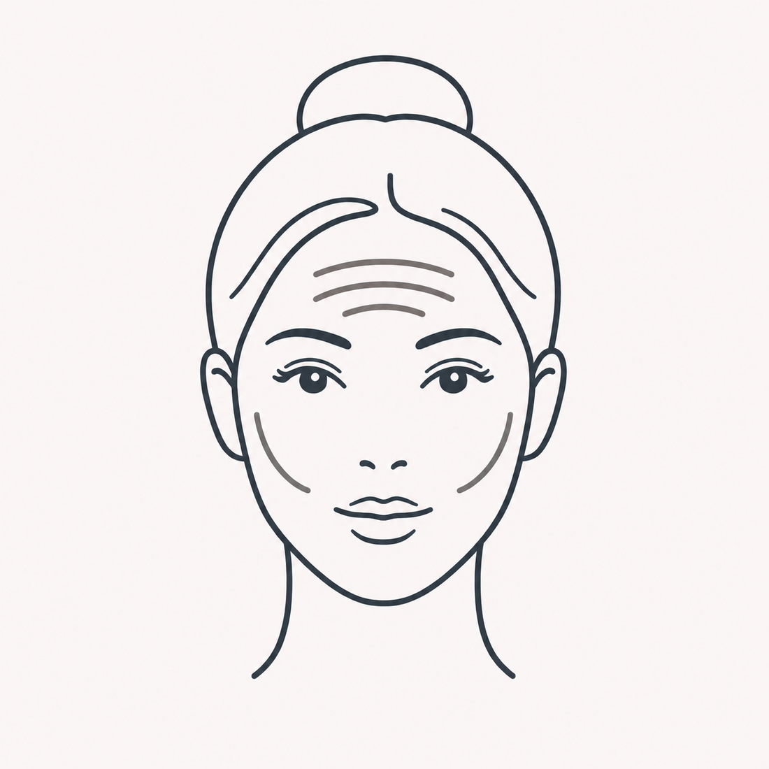 Forehead treatment zone, showing where the frontalis and corrugator muscles create horizontal and vertical lines